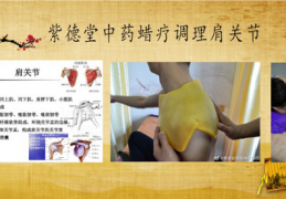 蜡疗、中药蜡疗调理肩关节扭挫伤的案例操作介绍